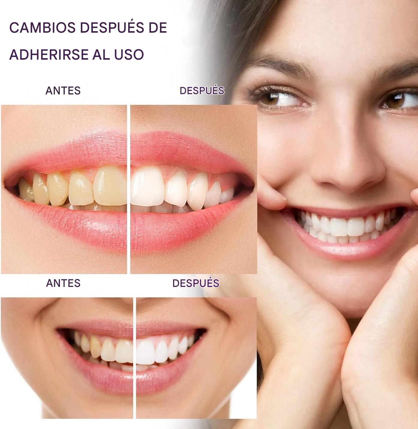 Fórmula Violeta, Equilibra el Color y Mejora el Brillo Dental